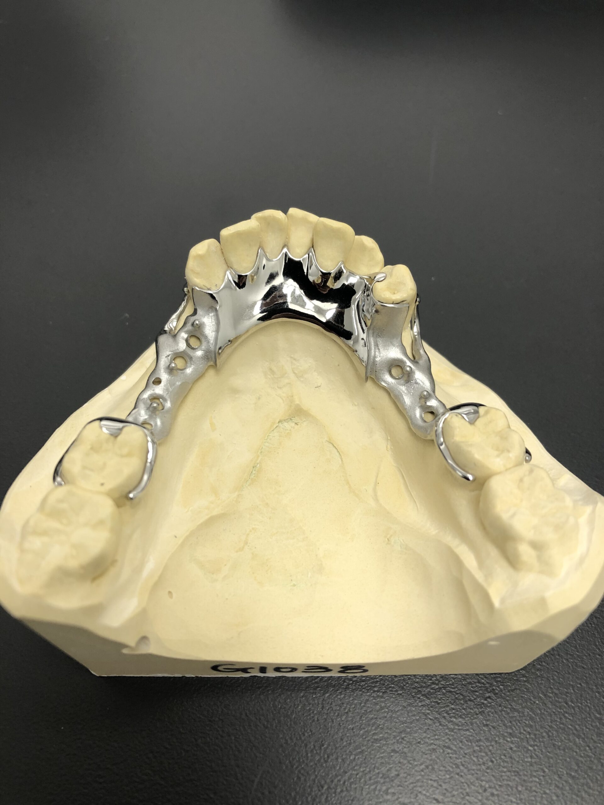 PARTIAL DENTURE FRAMEWORK ARE YOU MISSING TEETH? YYC Denture Clinic